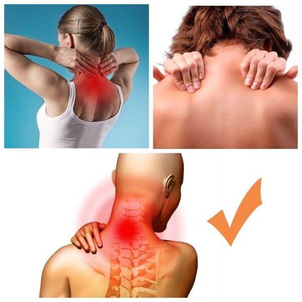 symptômes de l'ostéochondrose cervicale