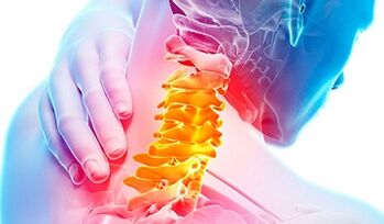 Signes d'ostéochondose de la colonne cervicale