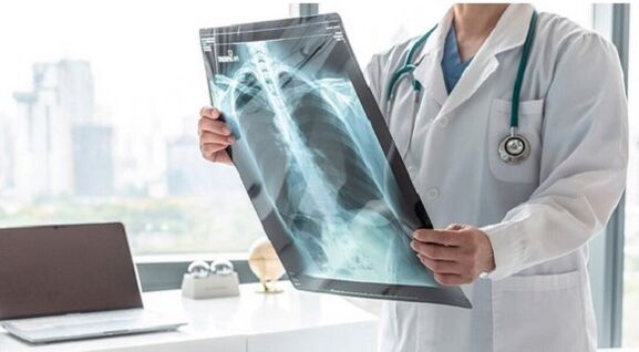Diagnostic radiologique de la douleur sous l'omoplate gauche