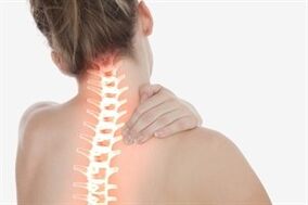 Ostéochondrose cervicale chez une femme